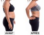 CRYO SHAPE X1
