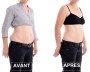 CRYO SHAPE X1