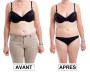 CRYO SHAPE X1