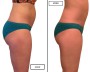 PANTY CRYO JADE X2