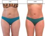 PANTY CRYO JADE X2