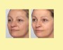 VITAMINE C SERUM